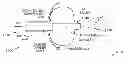 Fig. 01 - Zero-pressure balloon catheter and method for using the catheter