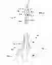 Fig. 03 - Zero-pressure balloon catheter and method for using the catheter