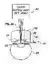 Fig. 01 - Patient interface for ophthalmologic diagnostic and interventional procedures