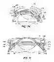 Fig. 22 - Patient interface for ophthalmologic diagnostic and interventional procedures