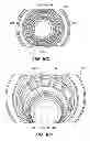 Fig. 32 - Patient interface for ophthalmologic diagnostic and interventional procedures
