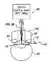 Fig. 01 - Patient interface for ophthalmologic diagnostic and interventional procedures