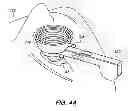 Fig. 07 - Patient interface for ophthalmologic diagnostic and interventional procedures