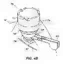 Fig. 08 - Patient interface for ophthalmologic diagnostic and interventional procedures