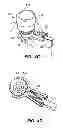 Fig. 09 - Patient interface for ophthalmologic diagnostic and interventional procedures