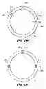 Fig. 35 - Patient interface for ophthalmologic diagnostic and interventional procedures