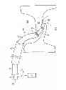 Fig. 01 - Welding Systems Useful for Closure of Cardiac Openings
