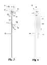 Fig. 03 - Ghost ring guide for assistance in percutaneous insertions