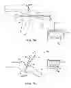 Fig. 09 - Sensing force during partial and total knee replacement surgery