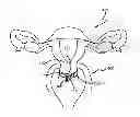 Fig. 01 - Cervical Stretch Band
