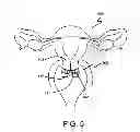 Fig. 06 - Cervical Stretch Band