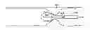 Fig. 01 - Medical retrieval device