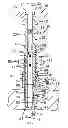 Fig. 01 - Method and apparatus for securing a guide tube
