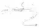 Fig. 01 - Catheter-based tissue remodeling devices and methods