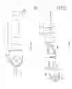 Fig. 02 - Atherectomy devices and methods
