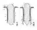 Fig. 04 - Anoscope