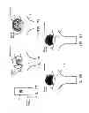 Fig. 40 - Method and apparatus for restricting flow through an opening in the side wall