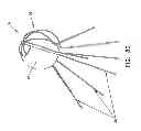 Fig. 41 - Method and apparatus for restricting flow through an opening in the side wall