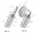 Fig. 71 - Method and apparatus for restricting flow through an opening in the side wall