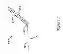 Fig. 08 - Embolic debris deflector