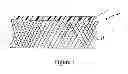 Fig. 02 - Cellulose-containing medical device having a multi-layer structure produced without adhesive
