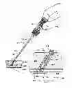 Fig. 01 - Vascular sealing device with locking hub