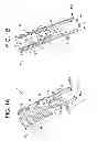 Fig. 02 - Suture anchor system with compressible distal tip