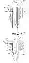 Fig. 09 - Suture anchor system with compressible distal tip