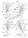 Fig. 02 - Suture anchors and methods of use