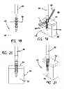 Fig. 07 - Suture anchors and methods of use