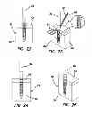 Fig. 08 - Suture anchors and methods of use