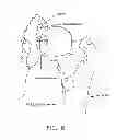 Fig. 09 - Method and apparatus for re-attaching the labrum to the acetabulum, including the provision and use of a novel suture anchor system