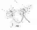 Fig. 07 - Suture anchor kit