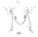 Fig. 08 - Suture anchor kit
