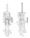 Fig. 24 - Suture anchor kit