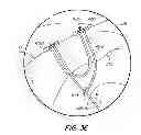 Fig. 29 - Suture anchor kit