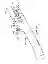 Fig. 30 - Suture anchor kit