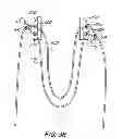 Fig. 31 - Suture anchor kit