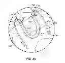Fig. 32 - Suture anchor kit