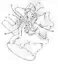 Fig. 01 - Spinous process plate and connector assembly and method