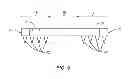 Fig. 07 - Spinous process plate and connector assembly and method