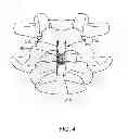 Fig. 05 - Bone tissue clamp