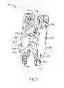 Fig. 08 - Bone tissue clamp