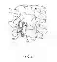 Fig. 10 - Bone tissue clamp
