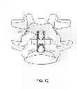Fig. 13 - Bone tissue clamp