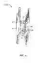 Fig. 15 - Bone tissue clamp