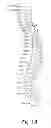 Fig. 02 - SPINAL FUSION INSTRUMENTATION AND SYSTEMS AND METHODS THEREOF