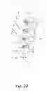 Fig. 03 - SPINAL FUSION INSTRUMENTATION AND SYSTEMS AND METHODS THEREOF
