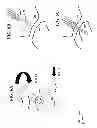 Fig. 07 - Facet screw system and method