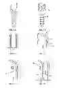 Fig. 06 - Bone fastener for a spinal surgical system